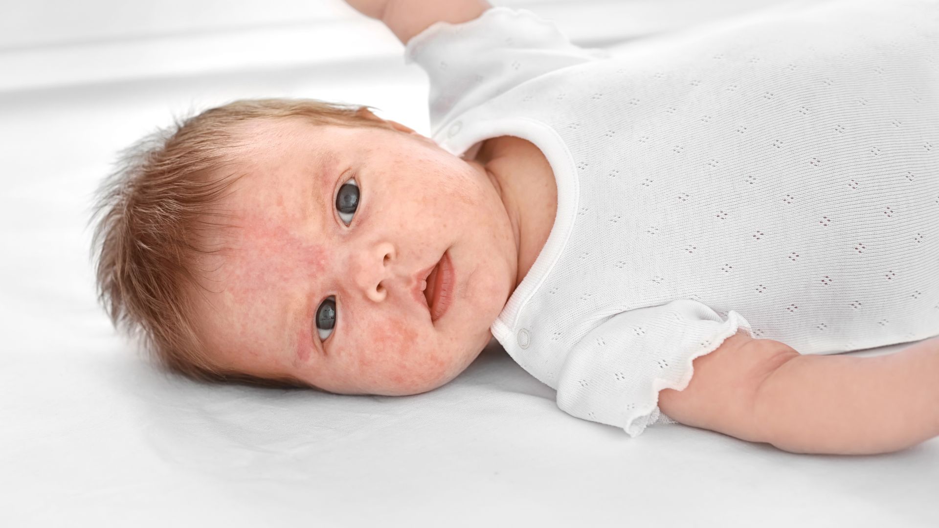 alergolog dzieciecy Białystok Alermedic Poradnia alergologiczna Białystok